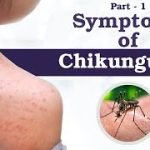 symtptoms of chikungunya